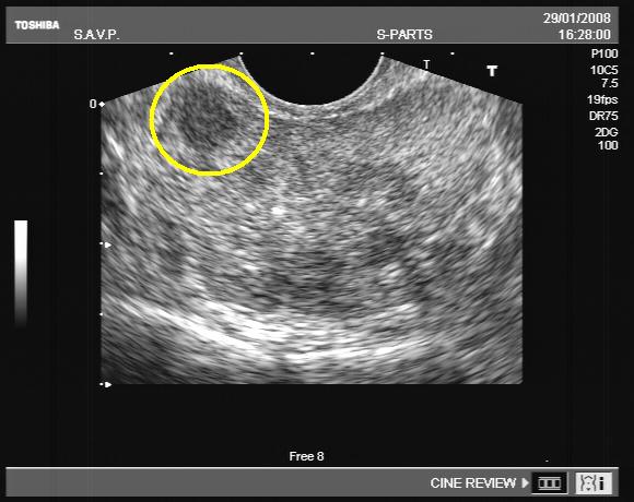 Valori normale la ecografia abdominală | Imagistice | Analize